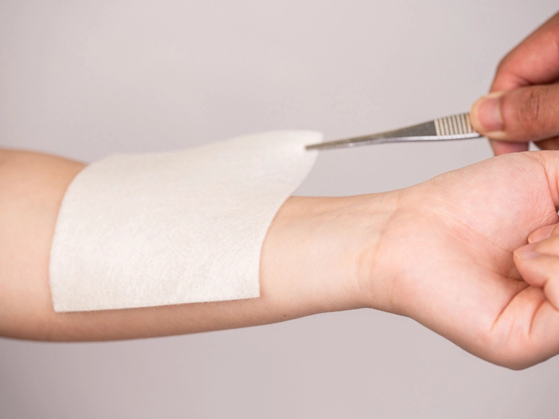 How Does Medical Dressing Device Work?