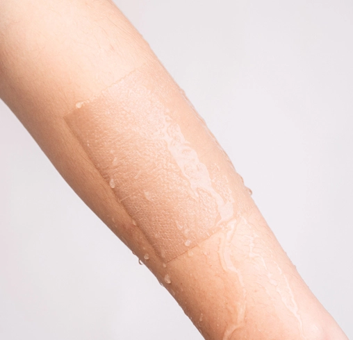 scar-treatment-gel