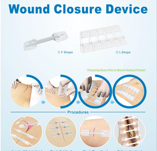 sleep-device-monitoring